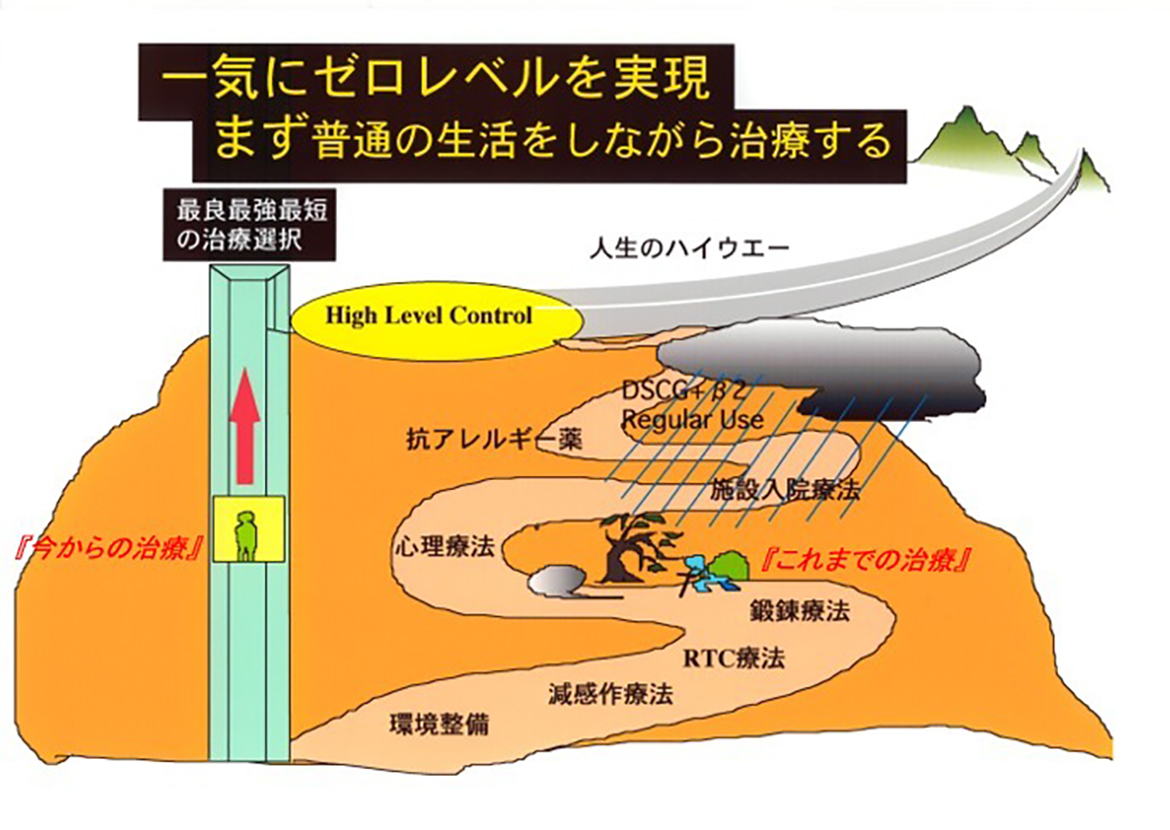 一気にゼロレベルを実現